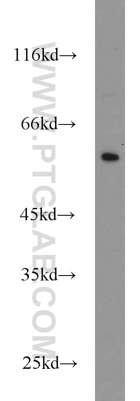 Western Blot (WB) analysis of human placenta tissue using CYP4F12 Polyclonal antibody (13243-1-AP)