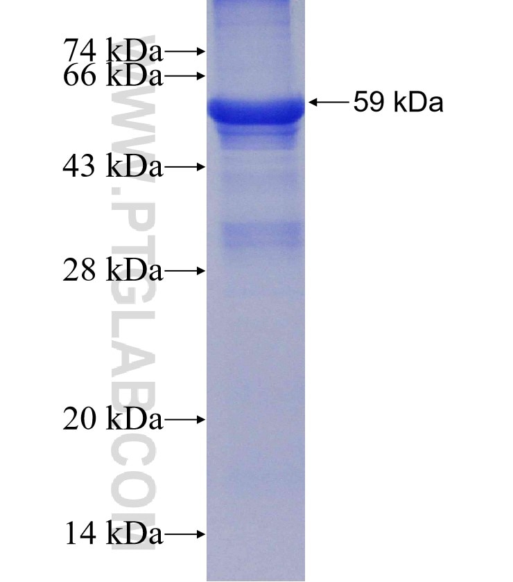 CYP4F12 fusion protein Ag3957 SDS-PAGE