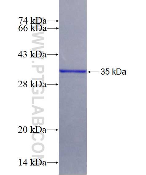 CYP4F2 fusion protein Ag26523 SDS-PAGE