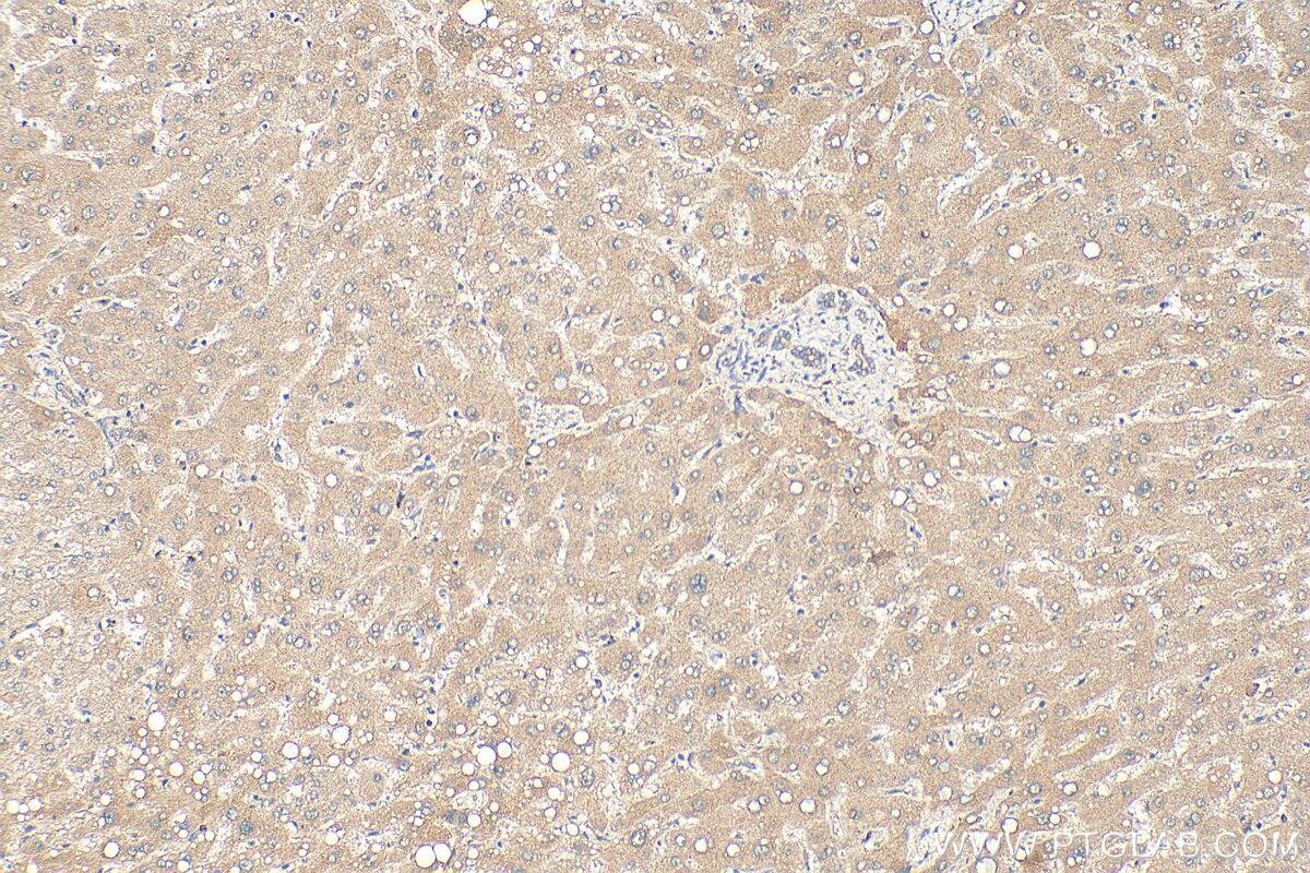 Immunohistochemistry (IHC) staining of human liver tissue using CYP4F2-Specific Polyclonal antibody (20010-1-AP)