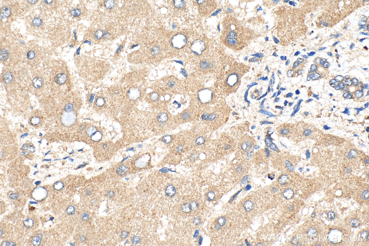 Immunohistochemistry (IHC) staining of human liver tissue using CYP4F2-Specific Polyclonal antibody (20010-1-AP)