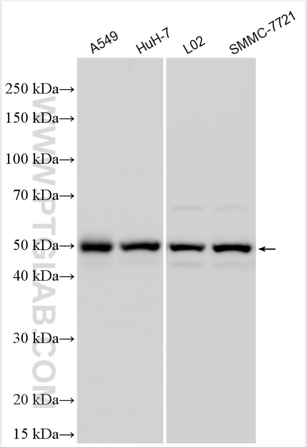 Western Blot (WB) analysis of various lysates using CYP4F2-Specific Polyclonal antibody (20010-1-AP)