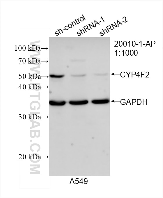 Western Blot (WB) analysis of A549 cells using CYP4F2-Specific Polyclonal antibody (20010-1-AP)