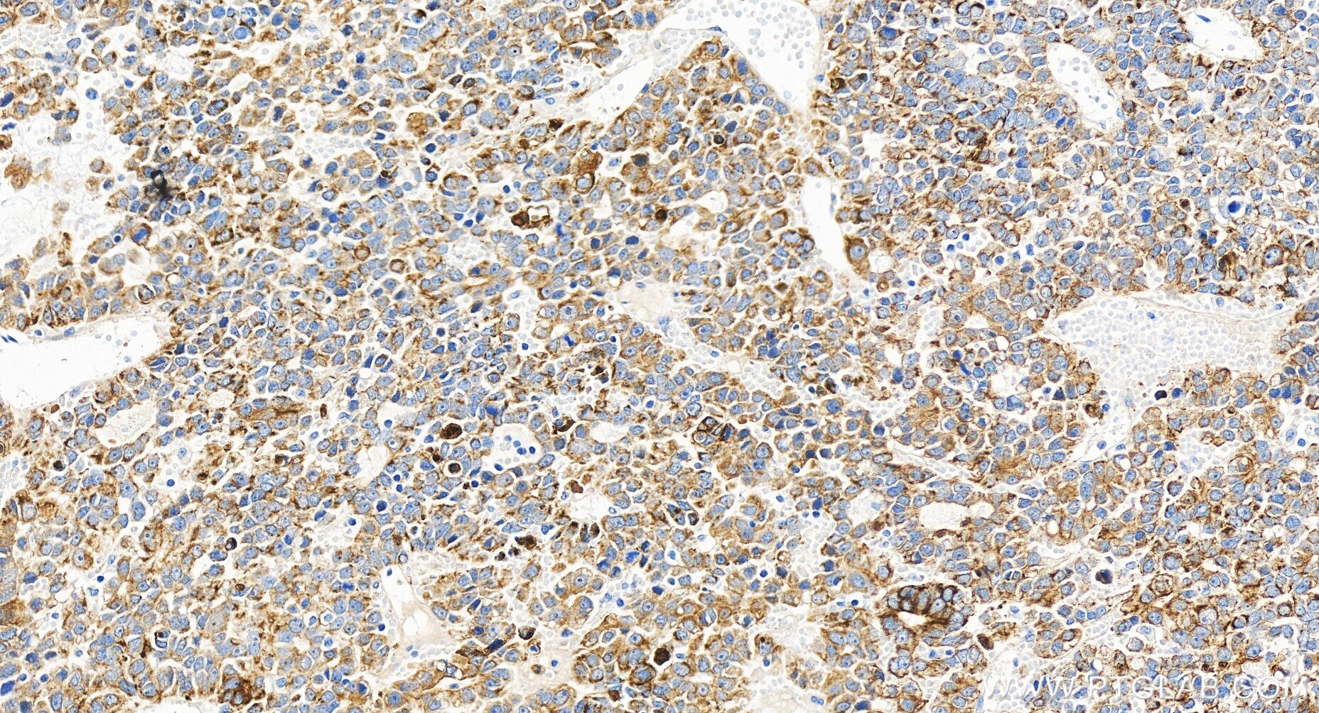 CYP4F2-Specific