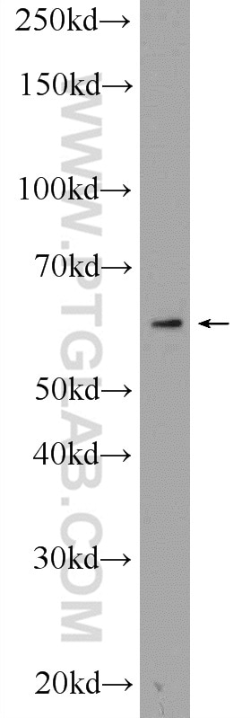 Western Blot (WB) analysis of HL-60 cells using CYP4F3 Polyclonal antibody (19701-1-AP)