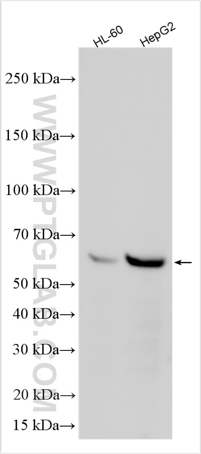 Western Blot (WB) analysis of various lysates using CYP4F3 Polyclonal antibody (19701-1-AP)