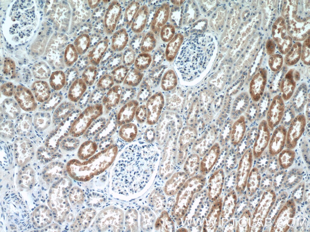 Immunohistochemistry (IHC) staining of human kidney tissue using CYP4F8 Polyclonal antibody (20011-1-AP)