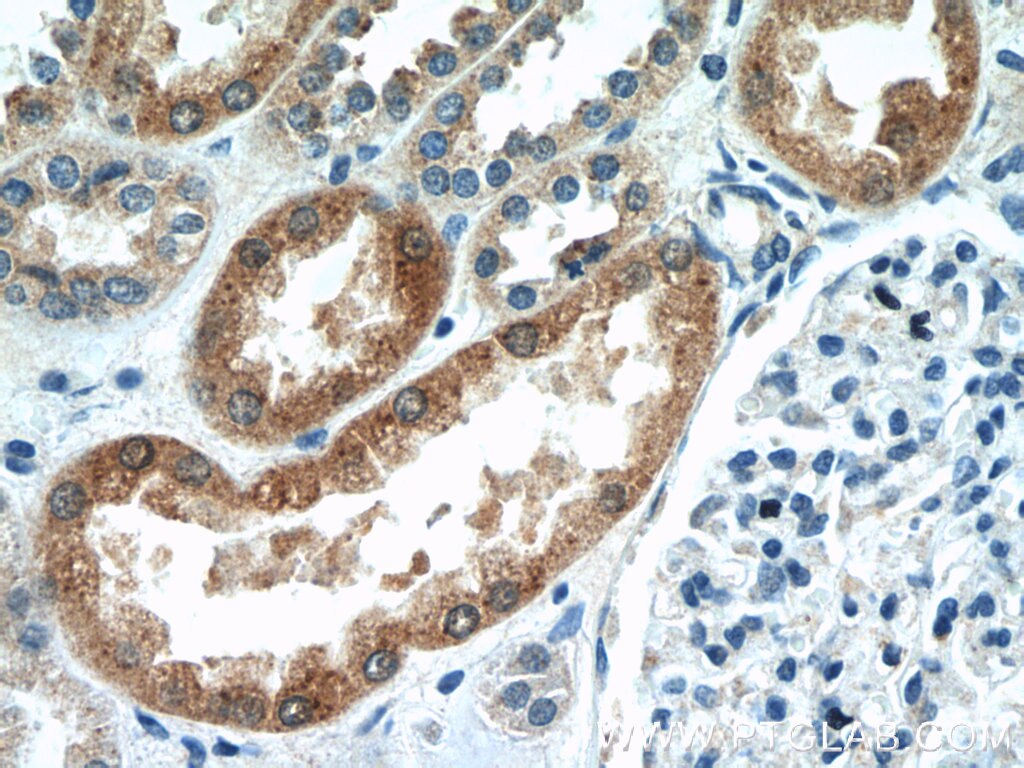 Immunohistochemistry (IHC) staining of human kidney tissue using CYP4F8 Polyclonal antibody (20011-1-AP)
