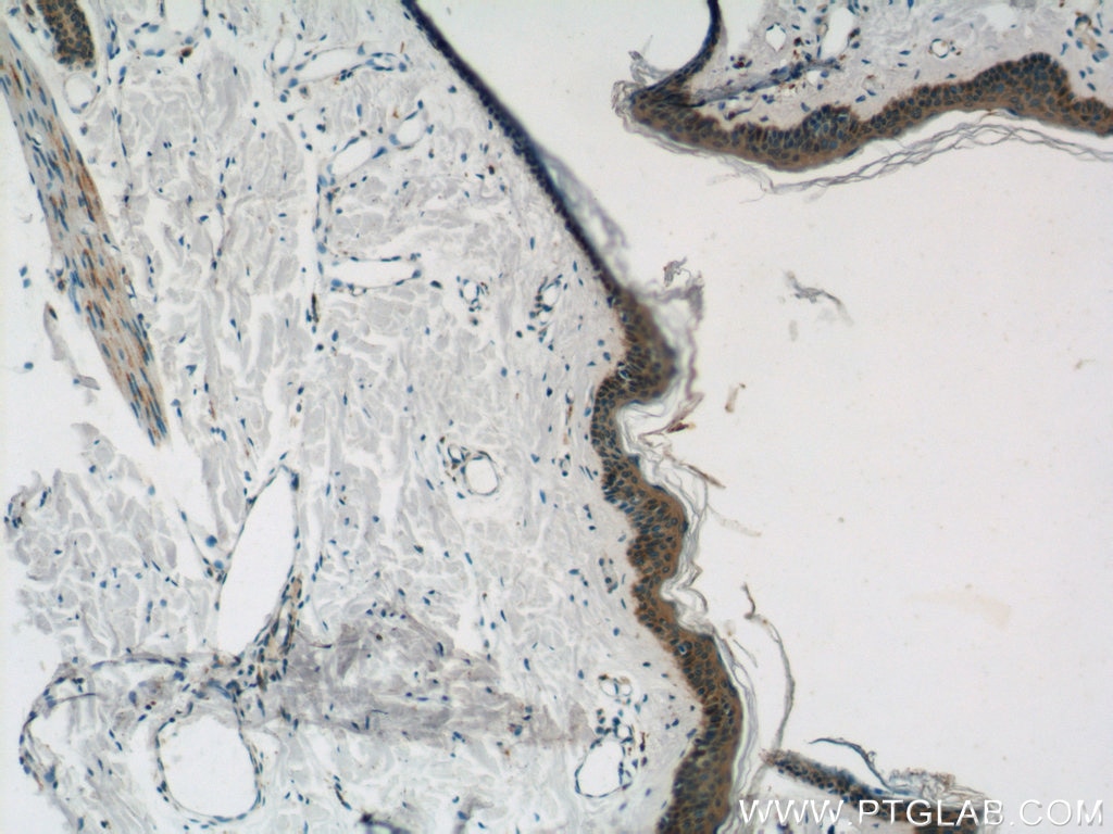 IHC staining of human skin using 20011-1-AP