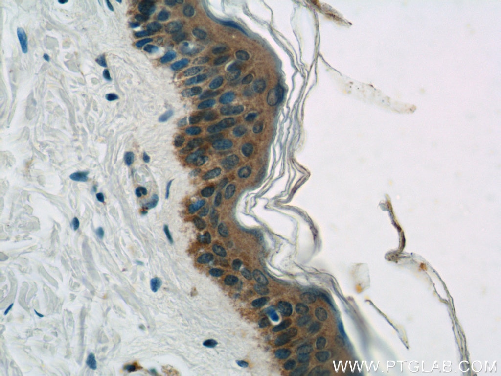 Immunohistochemistry (IHC) staining of human skin tissue using CYP4F8 Polyclonal antibody (20011-1-AP)