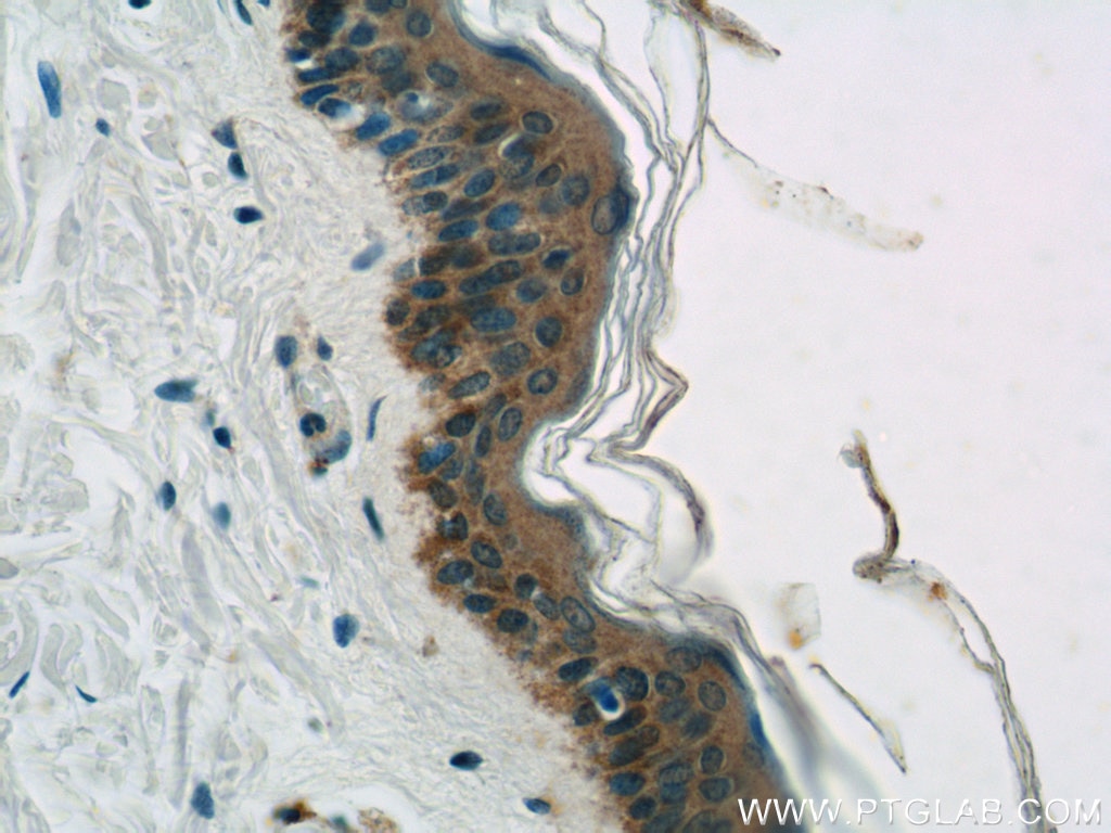 IHC staining of human skin using 20011-1-AP