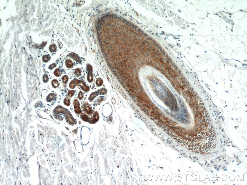 Immunohistochemistry (IHC) staining of human skin tissue using CYP4F8 Polyclonal antibody (20011-1-AP)