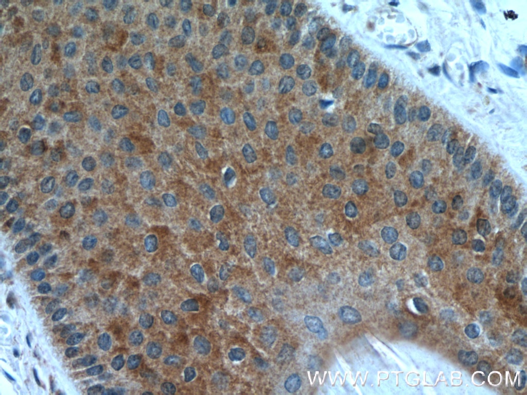 Immunohistochemistry (IHC) staining of human skin tissue using CYP4F8 Polyclonal antibody (20011-1-AP)