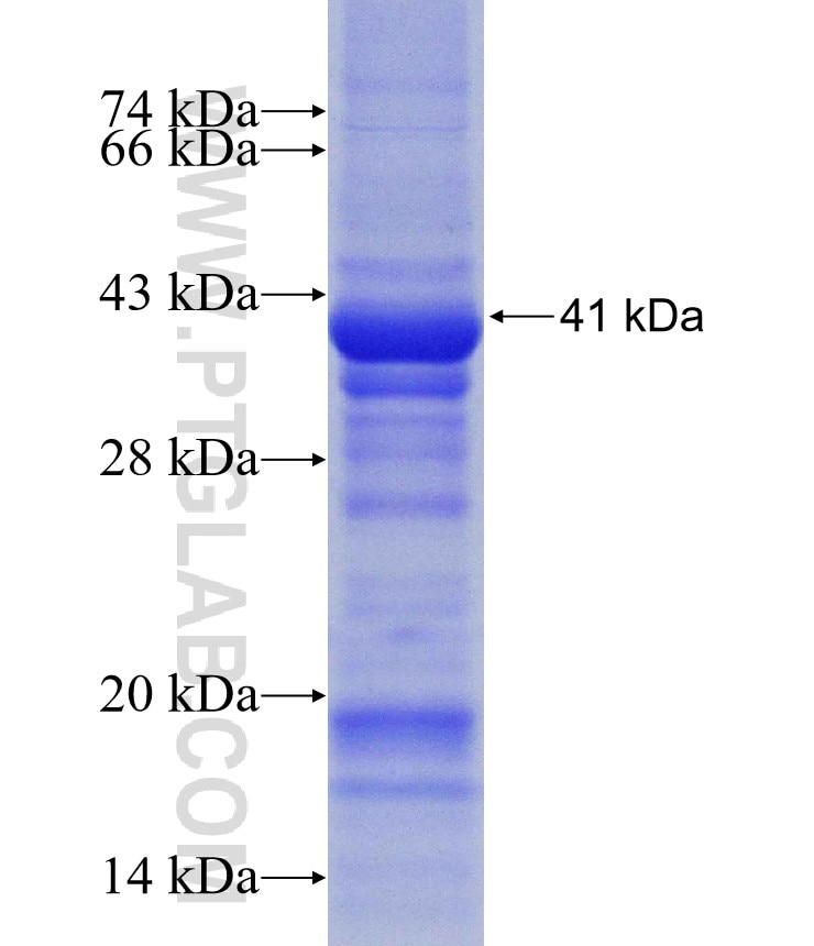 CYP4V2 fusion protein Ag31002 SDS-PAGE