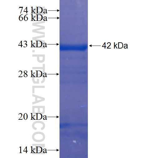 CYP4X1 fusion protein Ag4686 SDS-PAGE