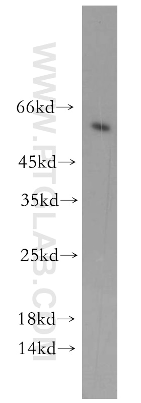 Western Blot (WB) analysis of MDA-MB-453s cells using CYP4Z1-Specific Polyclonal antibody (20142-1-AP)