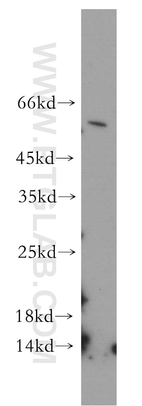 Western Blot (WB) analysis of HeLa cells using CYP4Z1-Specific Polyclonal antibody (20142-1-AP)