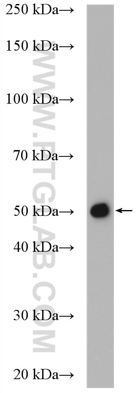 Western Blot (WB) analysis of rat liver tissue using CYP51A1 Polyclonal antibody (13431-1-AP)