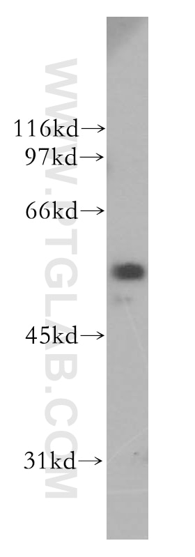 CYP51A1 Polyclonal antibody