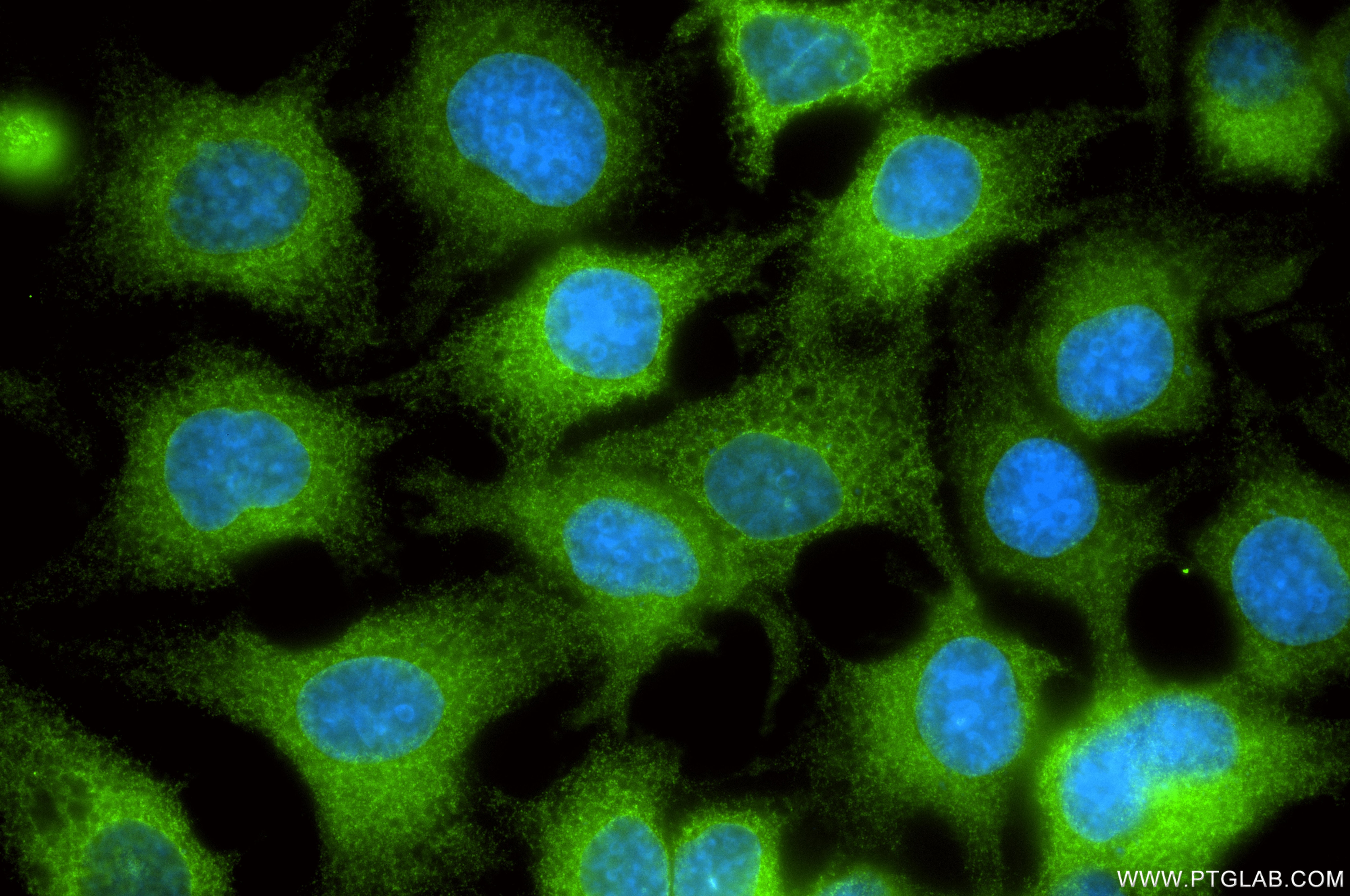 Immunofluorescence (IF) / fluorescent staining of HuH-7 cells using CYP51A1 Recombinant monoclonal antibody (84705-4-RR)