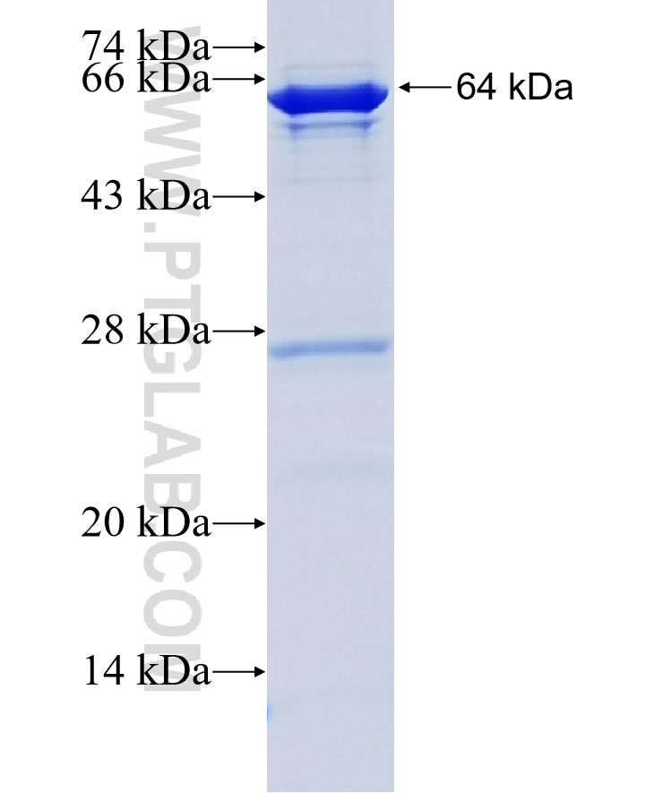 CYP51A1 fusion protein Ag4235 SDS-PAGE