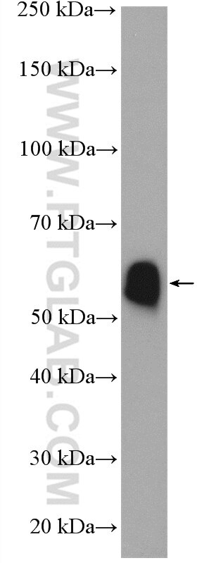 Western Blot (WB) analysis of rat liver tissue using CYP7A1 Polyclonal antibody (18054-1-AP)