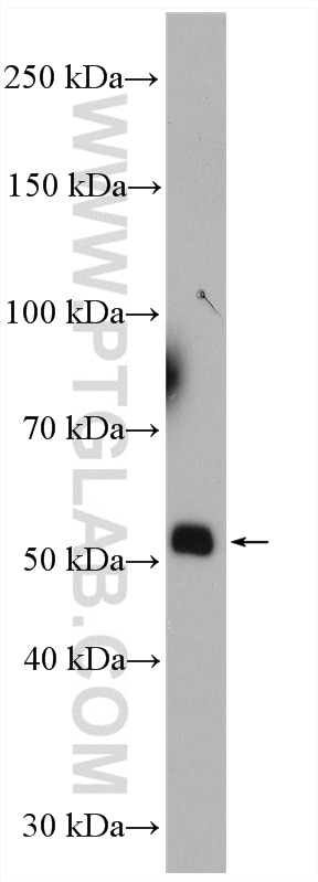 Western Blot (WB) analysis of mouse liver tissue using CYP7A1 Polyclonal antibody (18054-1-AP)