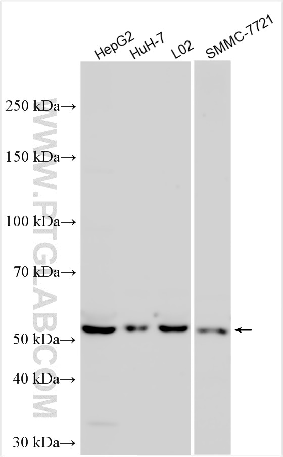 Western Blot (WB) analysis of various lysates using CYP7A1 Polyclonal antibody (18054-1-AP)