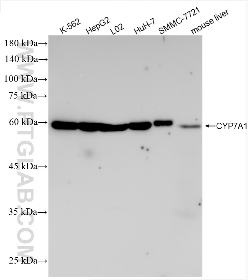 CYP7A1