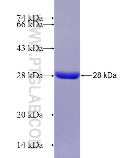 CYP7A1 fusion protein Ag26621 SDS-PAGE