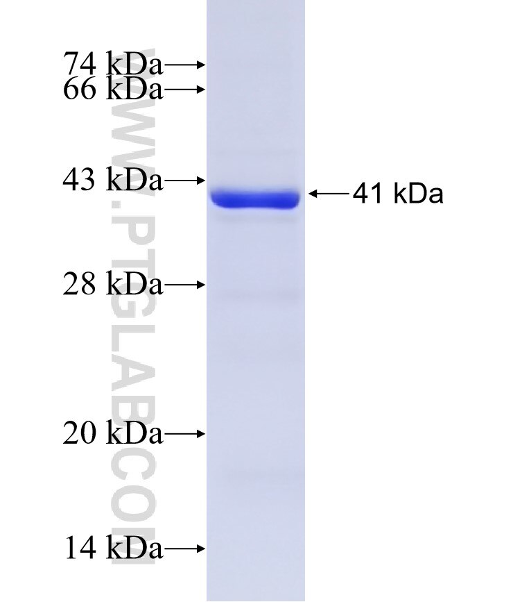 CYP7A1 fusion protein Ag12681 SDS-PAGE