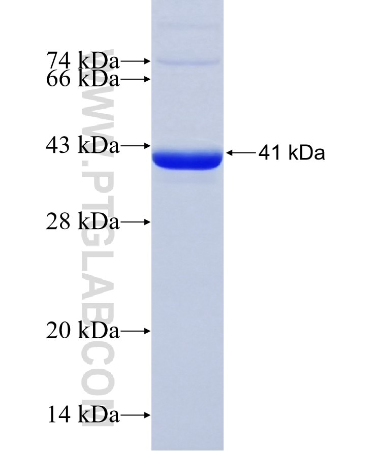 CYP7A1 fusion protein Ag12681 SDS-PAGE