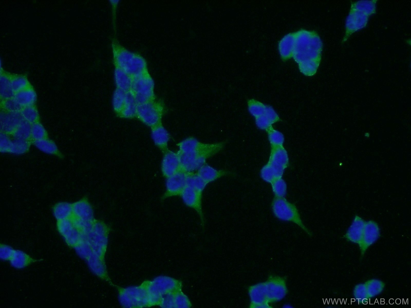 Immunofluorescence (IF) / fluorescent staining of HEK-293 cells using CYP7B1 Polyclonal antibody (24889-1-AP)