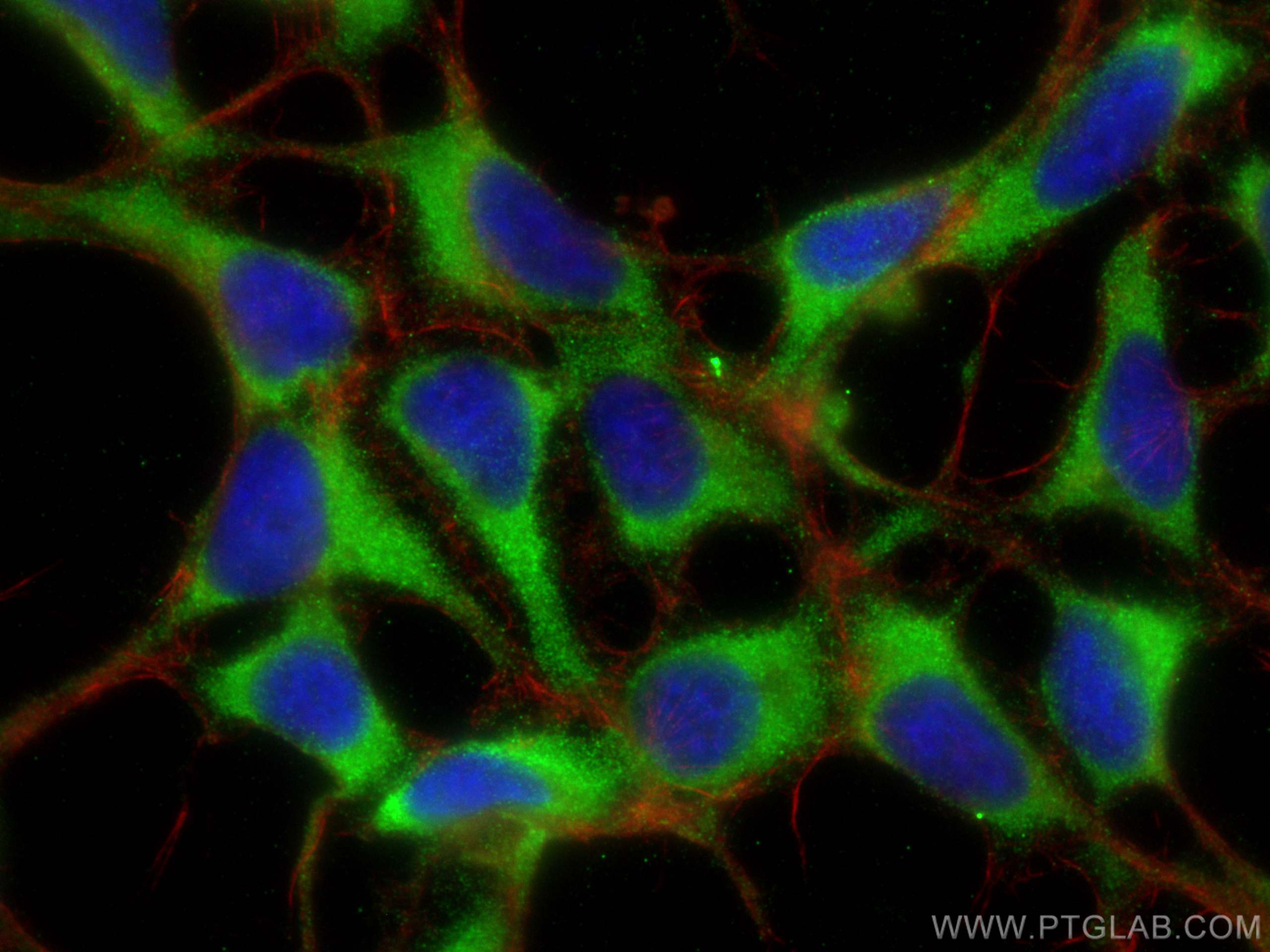 Immunofluorescence (IF) / fluorescent staining of HEK-293 cells using CYP7B1 Polyclonal antibody (24889-1-AP)