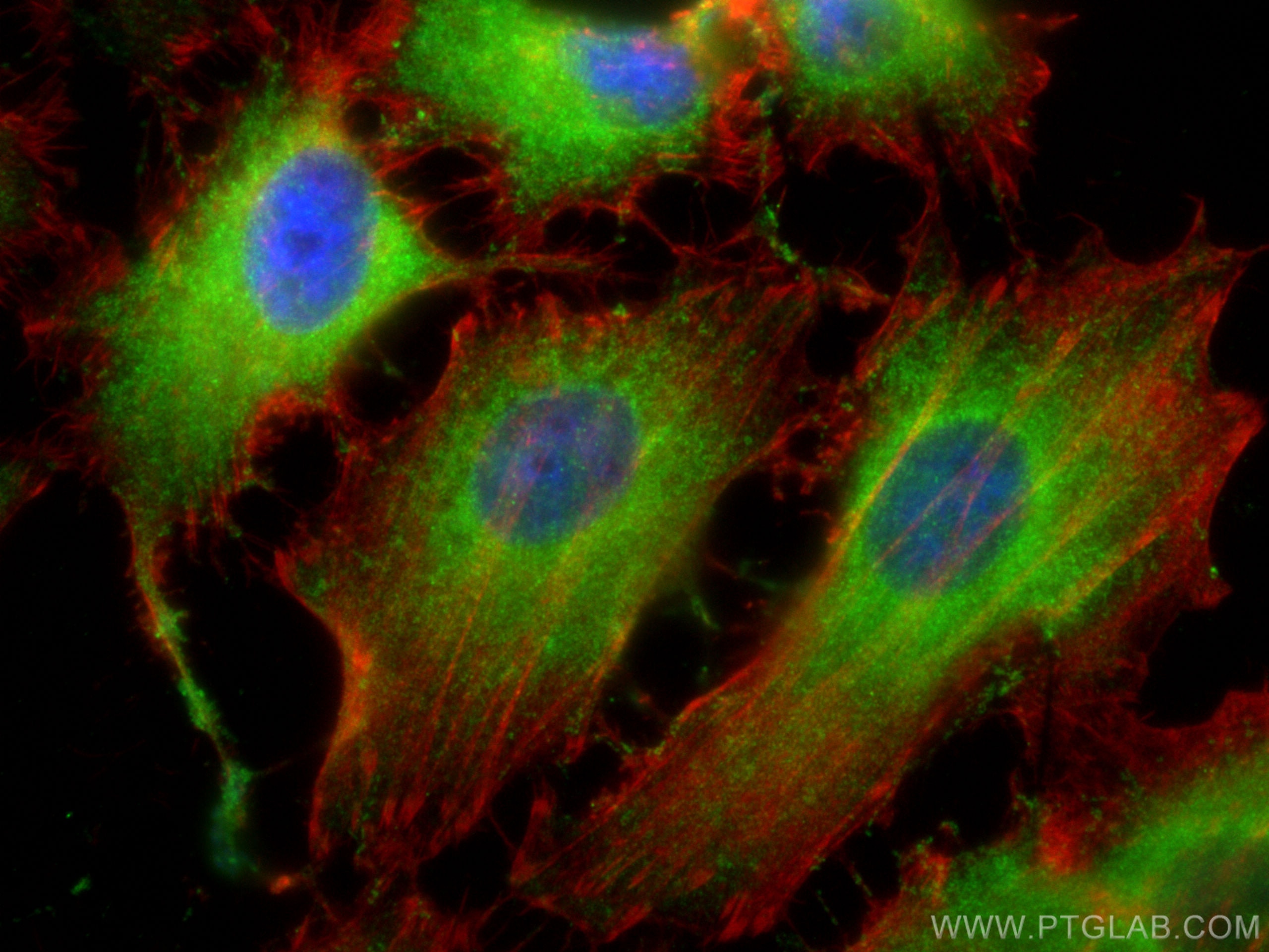 Immunofluorescence (IF) / fluorescent staining of HeLa cells using CYP7B1 Polyclonal antibody (24889-1-AP)
