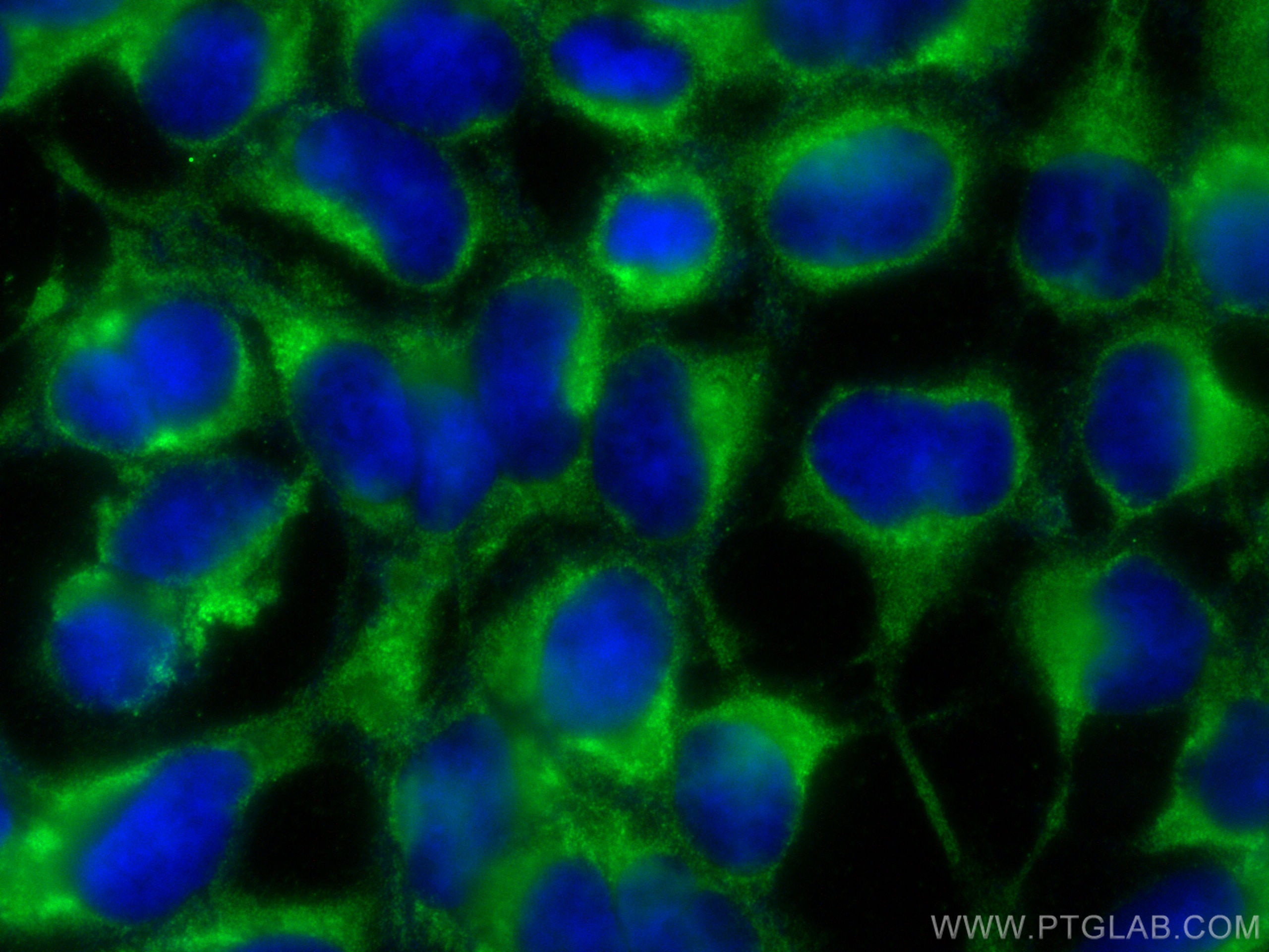 Immunofluorescence (IF) / fluorescent staining of HEK-293 cells using CYP7B1 Polyclonal antibody (24889-1-AP)