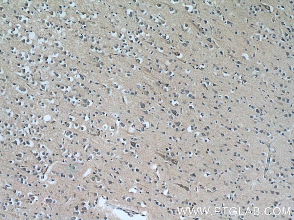 Immunohistochemistry (IHC) staining of human brain tissue using CYP7B1 Polyclonal antibody (24889-1-AP)