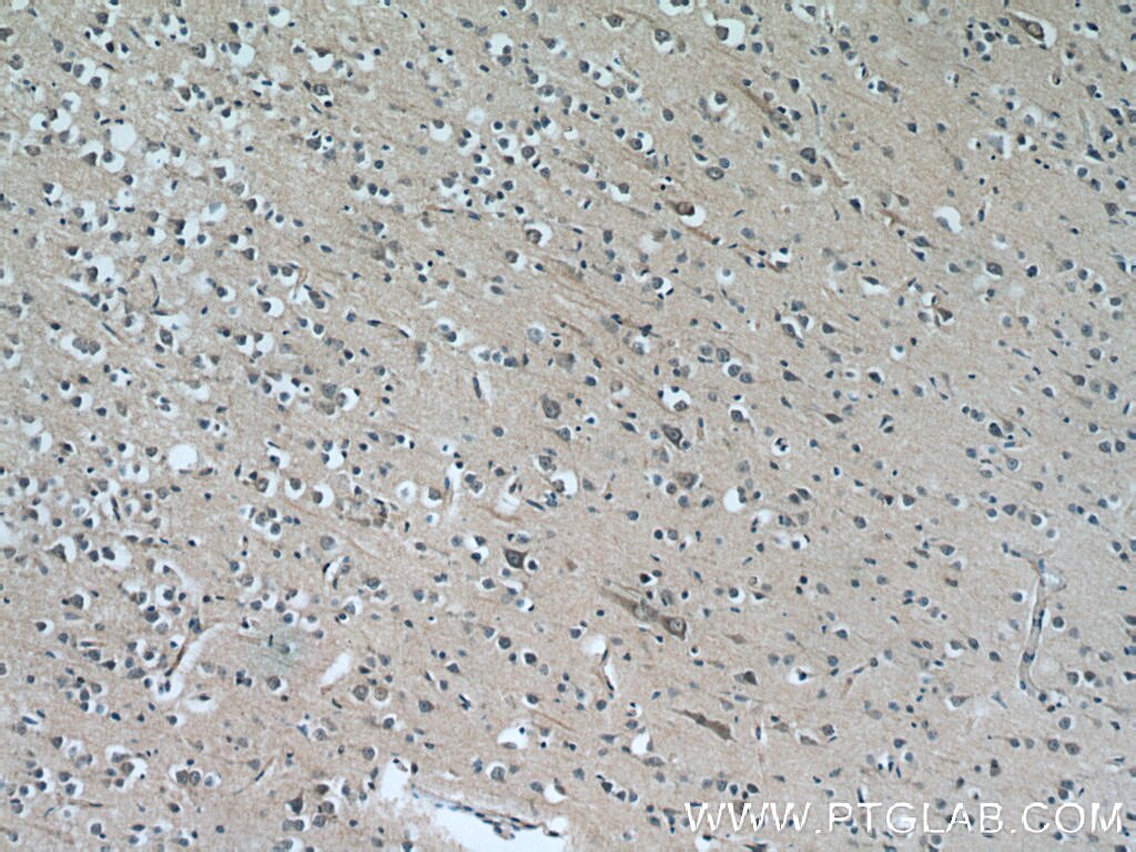 Immunohistochemistry (IHC) staining of human brain tissue using CYP7B1 Polyclonal antibody (24889-1-AP)