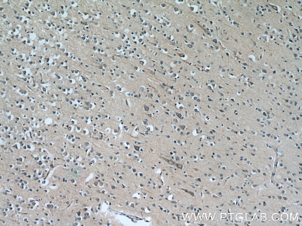 IHC staining of human brain using 24889-1-AP