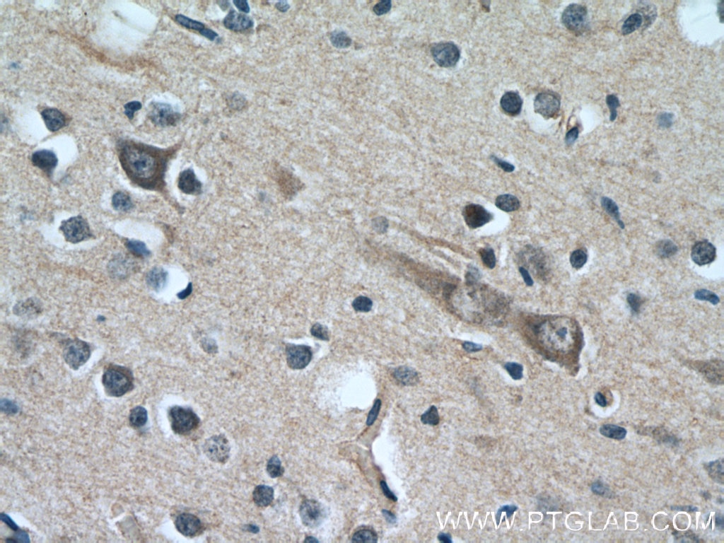 Immunohistochemistry (IHC) staining of human brain tissue using CYP7B1 Polyclonal antibody (24889-1-AP)