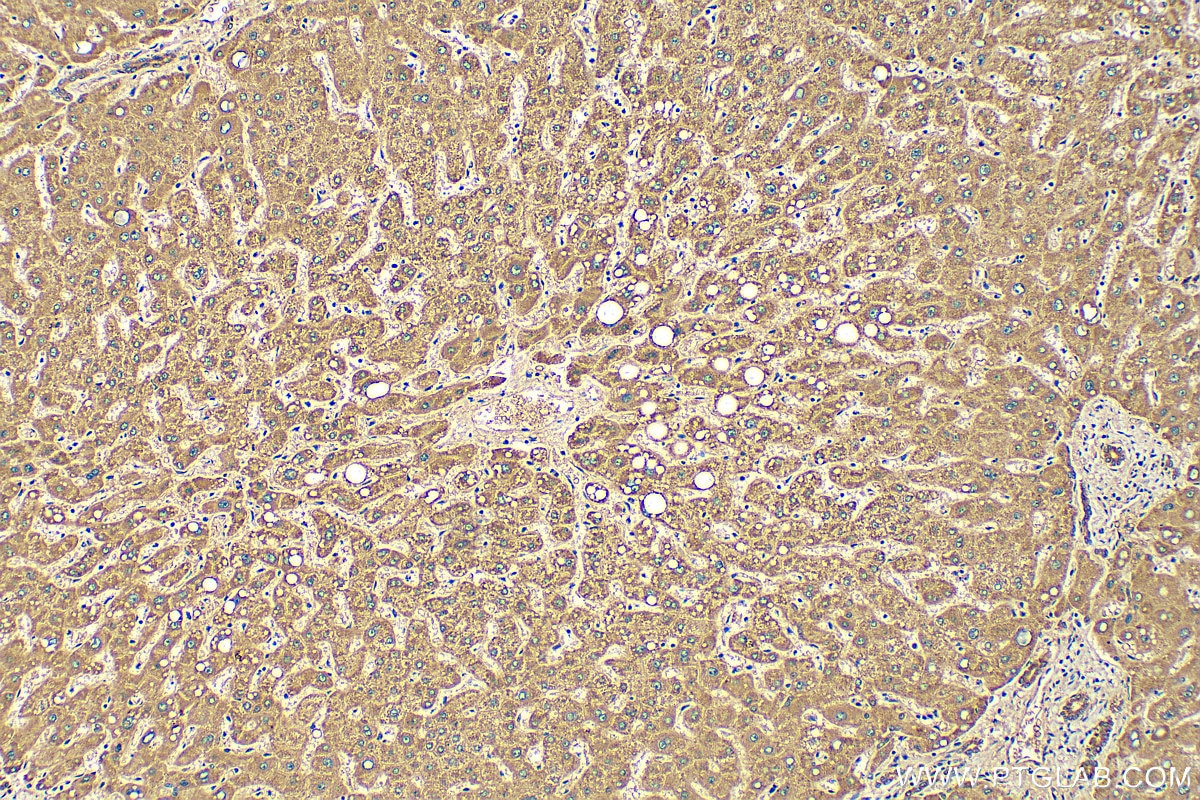 Immunohistochemistry (IHC) staining of human liver tissue using CYP7B1 Polyclonal antibody (24889-1-AP)