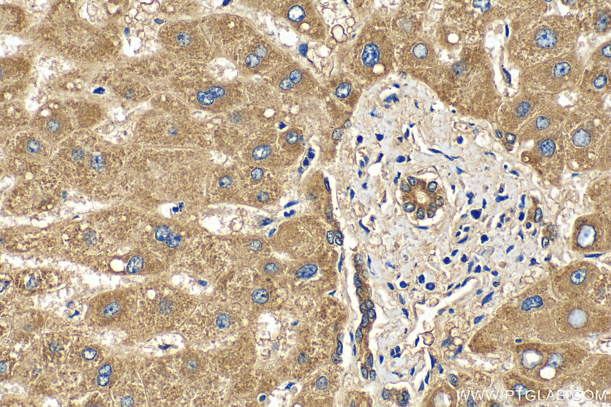 Immunohistochemistry (IHC) staining of human liver tissue using CYP7B1 Polyclonal antibody (24889-1-AP)