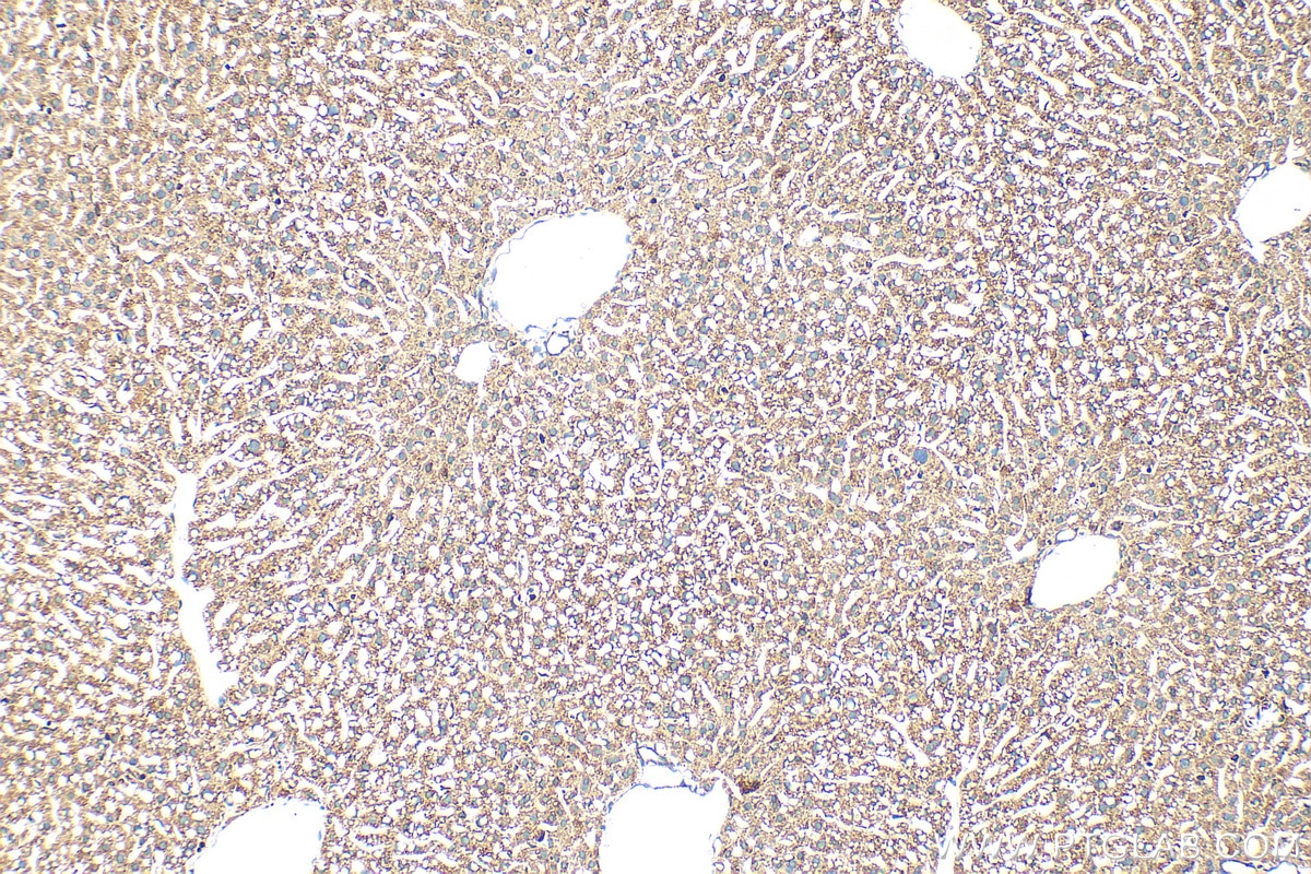 Immunohistochemistry (IHC) staining of mouse liver tissue using CYP7B1 Polyclonal antibody (24889-1-AP)