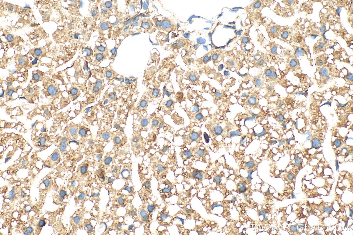 Immunohistochemistry (IHC) staining of mouse liver tissue using CYP7B1 Polyclonal antibody (24889-1-AP)