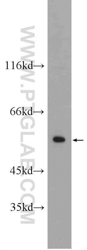 Western Blot (WB) analysis of A431 cells using CYP7B1 Polyclonal antibody (24889-1-AP)