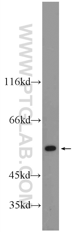 Western Blot (WB) analysis of HEK-293 cells using CYP7B1 Polyclonal antibody (24889-1-AP)