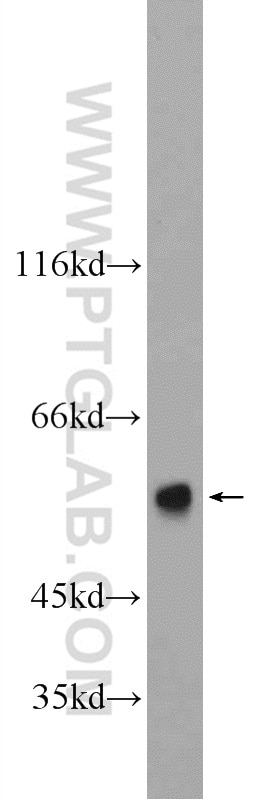 Western Blot (WB) analysis of mouse liver tissue using CYP7B1 Polyclonal antibody (24889-1-AP)