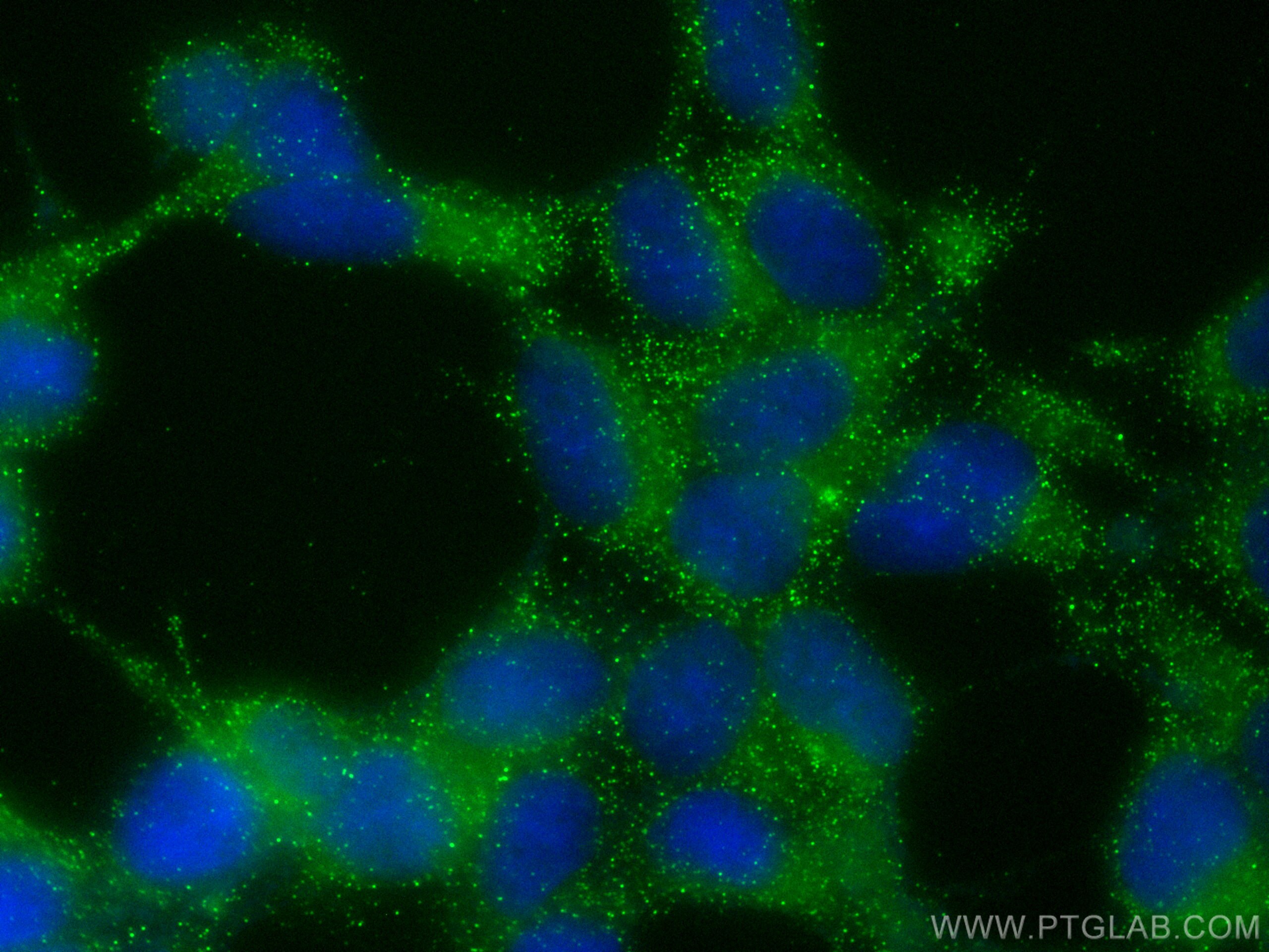 Immunofluorescence (IF) / fluorescent staining of HEK-293 cells using CYP7B1 Recombinant antibody (82927-2-RR)