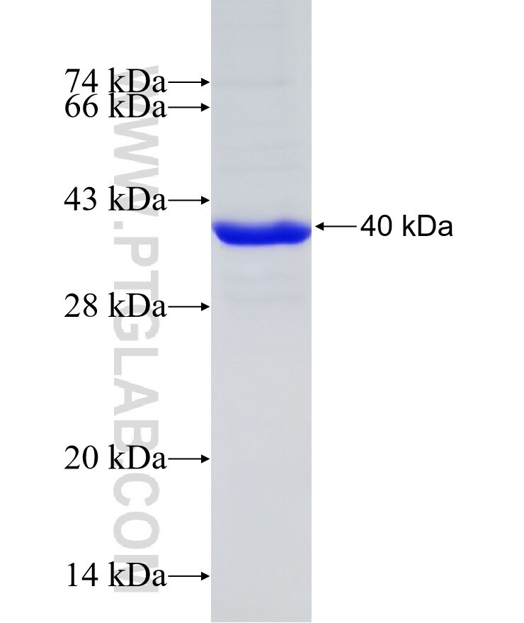 CYP7B1 fusion protein Ag19374 SDS-PAGE