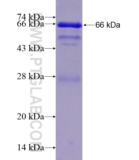 CYP7B1 fusion protein Ag19698 SDS-PAGE